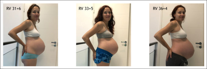 raskausmaha rv 32